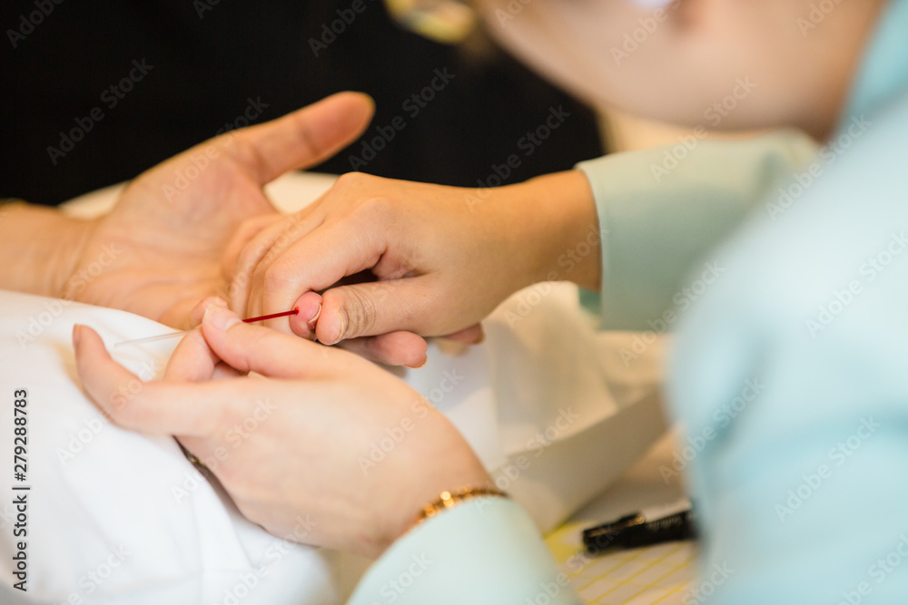 Blood collection staff are using a needle to penetrate the fingertip to check blood sugar levels. Blood collection staff are using a needle to penetrate the fingertip to check blood sugar levels.