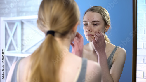 Young lady with face acne touching face in front of mirror, puberty skin problem