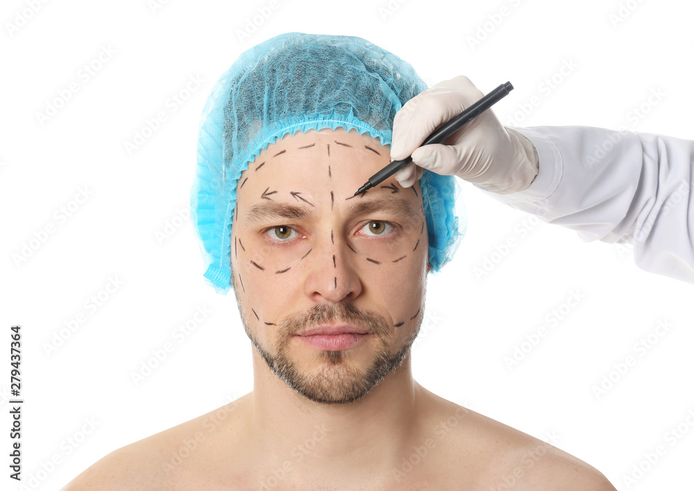 Doctor drawing marks on man's face for cosmetic surgery operation against white background Doctor drawing marks on man's face for cosmetic surgery operation against white background