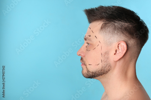 Man with marks on face for cosmetic surgery operation against blue background. Space for text photo