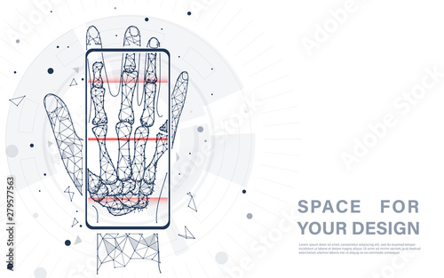 Smart healthcare technology concept. Smartphone display showing an x-ray