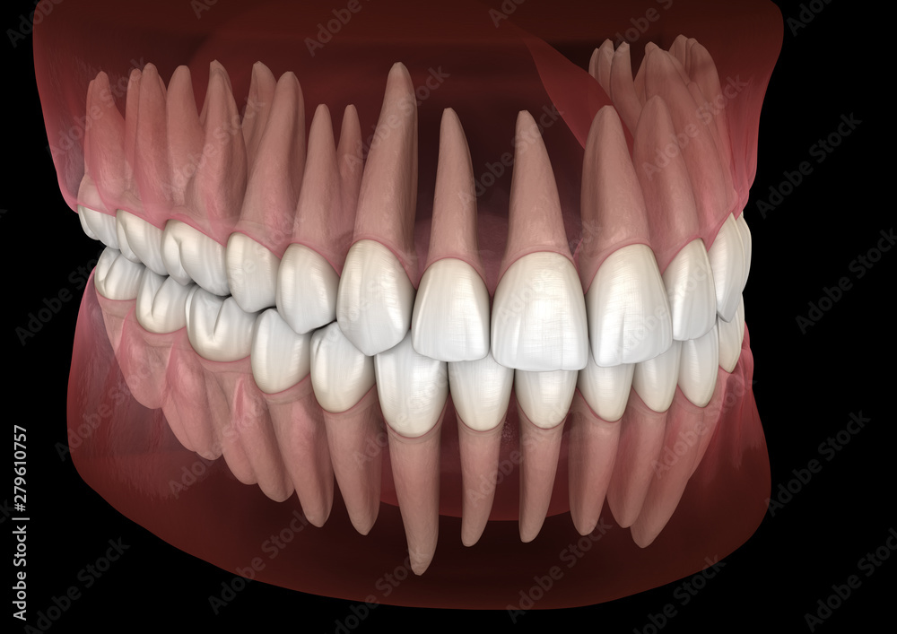 Fototapeta premium Morfologia ludzkich dziąseł i zębów żuchwy i szczęki. Medycznie dokładna ilustracja 3D zęba