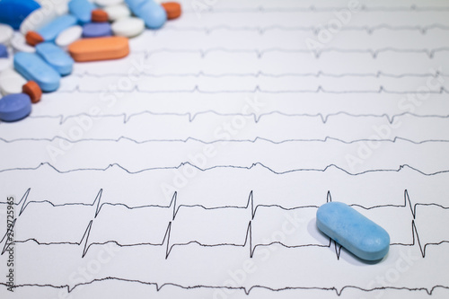 Electrocardiogram with Brugada syndrome. Colored pills on an EKG path. Sudden cardiac death due to arrhythmias. photo