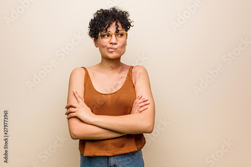Young african american woman with skin birth mark frowning face in displeasure, keeps arms folded.