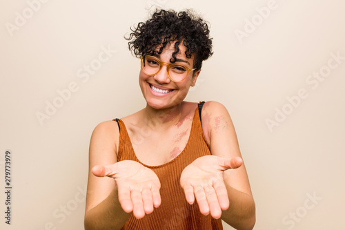 Young african american woman with skin birth mark holding something with palms, offering to camera.