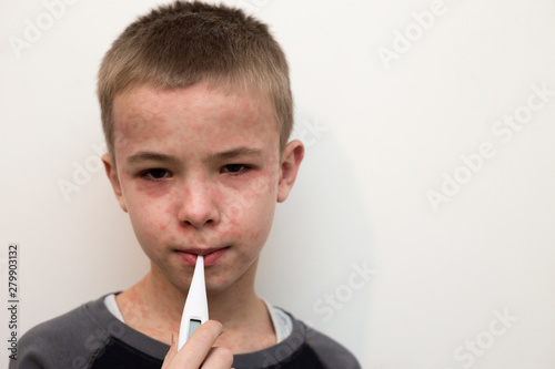 Obraz na plátně Portrait of sick sad boy child with thermometer having fever suffering from measles or chicken pox with bumps all over face