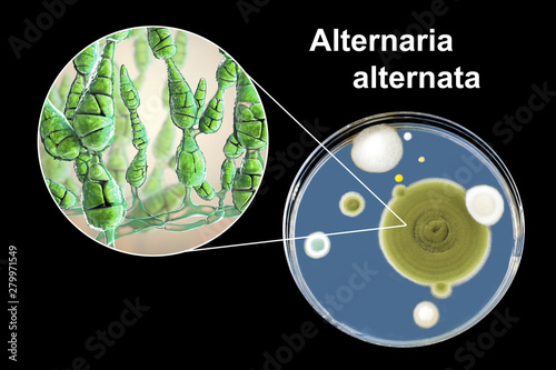 Mold Alternaria alternata, allergic fungus, 3D illustration and photo of colony on agar plate. Alternaria is the causative agent of plant diseases, is common indoor mold and causes allergy photo