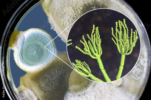 Penicillium mold fungi, 3D illustration and photo of colonies grown on nutrient medium photo