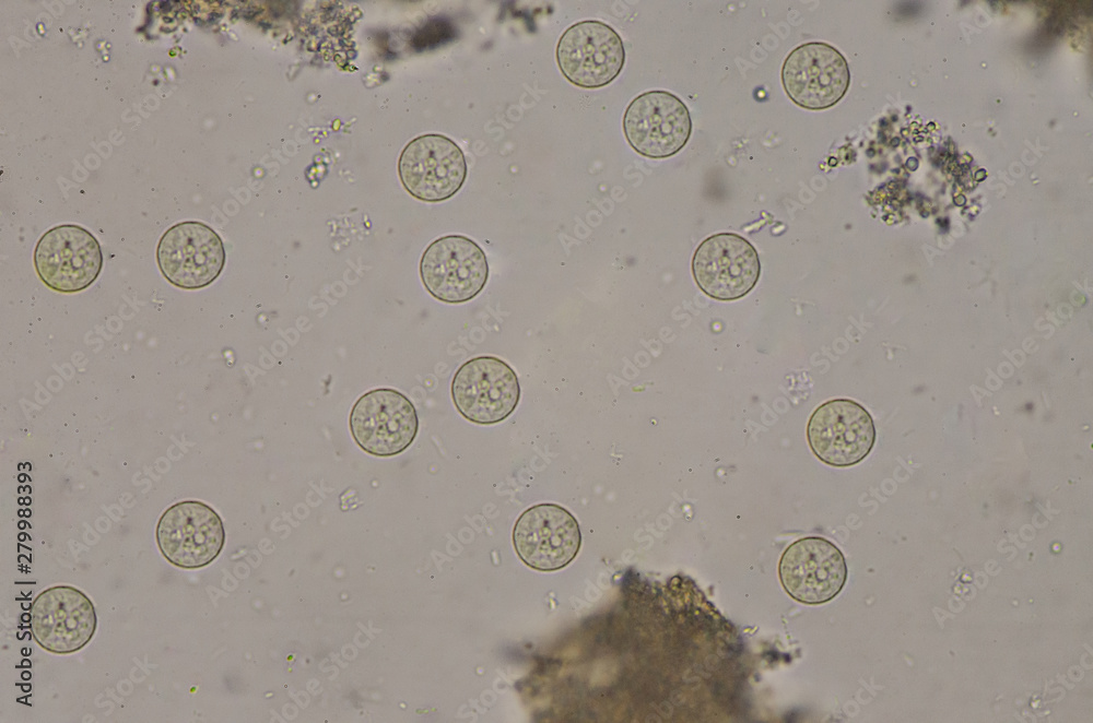 Entamoeba coli cysts stage in stool exam. Stock Photo Adobe Stock