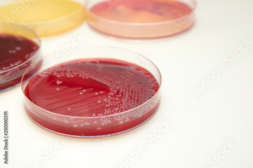 Escherichia coli (E. coli) culture in petri dish with macconkey agar. Bacterium culture growth in glassware. Medical tests in laboratory.