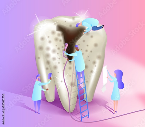 Tooth with caries isometric illustration. A group of doctors treat caries