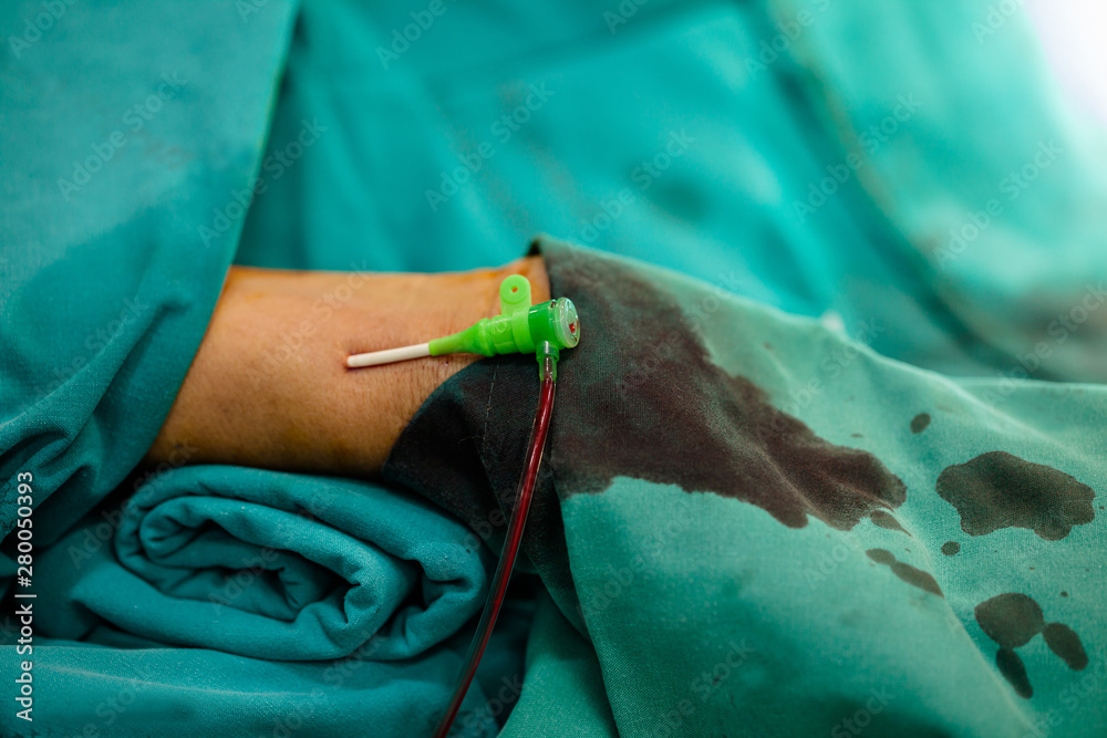 Modern Cath Lab with doctor, nurse and patient in hospital,patient