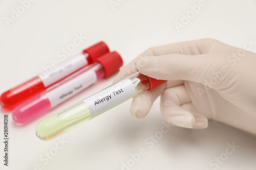 Doctor holding tube with label ALLERGY TEST on light background, closeup