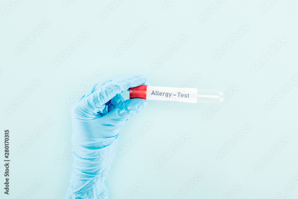 Obraz premium cropped view of doctor in latex glove holding empty test tube with allergy test lettering isolated on blue