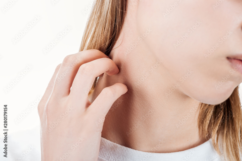 cropped view of woman itching neck with hand isolated on white cropped view of woman itching neck with hand isolated on white