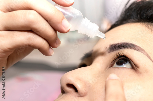 Closeup woman using eye drop. Woman applying eye drops healthcare concept.
