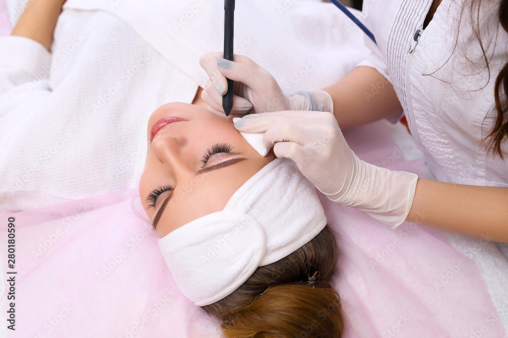 Radiofrequency coagulation of vessels on the face. Radiofrequency coagulation of vessels on the face.