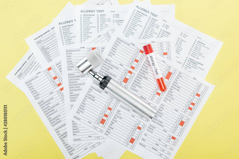 top view of test tube with allergy test lettering and dermatoscope on allergy test results isolated on yellow