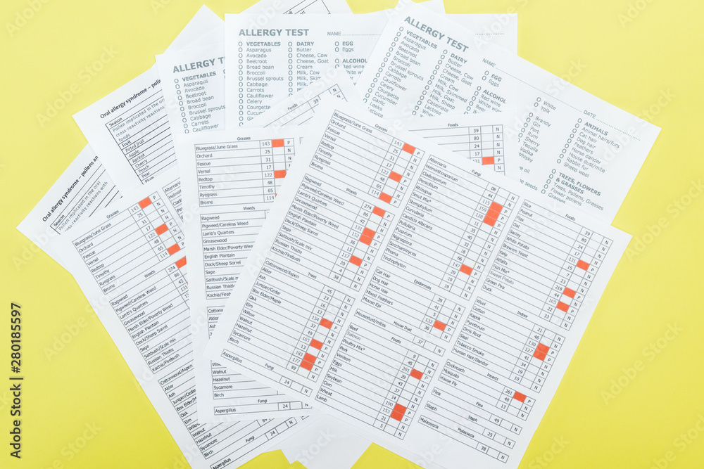 Obraz premium top view of allergy test results isolated on yellow