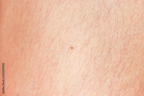 hairy legs before epilation with long black hair. photo