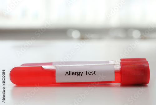 Tube with label ALLERGY TEST on white table