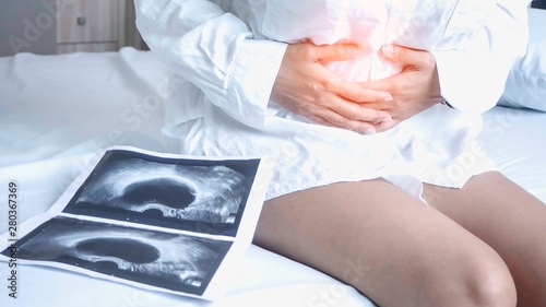 Uterus, ovaries, Ovarian cysts and abnormalities in cells, Close to each other, woman sitting closed to her stomach because of abdominal pain and a X-ray film.