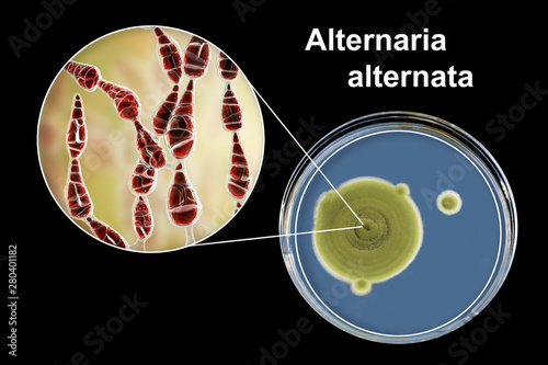 Mold Alternaria alternata, allergic fungus, 3D illustration and photo of colony on agar plate. Alternaria is the causative agent of plant diseases, is common indoor mold and causes allergy photo