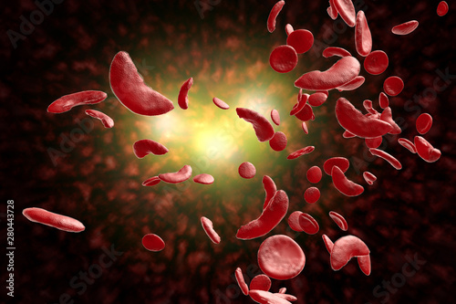 Sickle Cell Anemia 3D Illustration