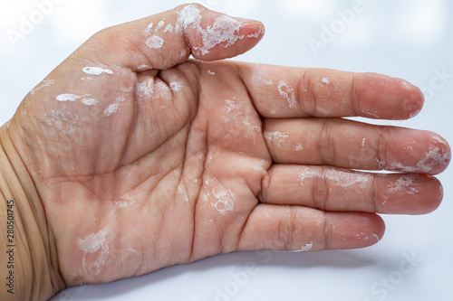 Woman s hand be stained with white acrylic glazing putty on white background Close up   Macro shot  Selective focus  Home concept