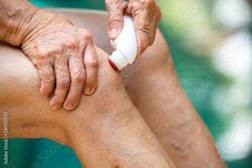 Принти на полотні Senior woman's hands massaging her knee, Using muscle pain reliever roll on medi