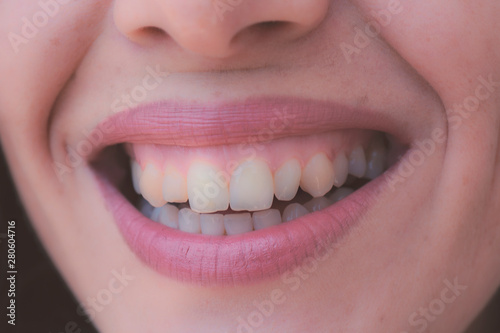 Closeup shot of human female face. Woman with pink lips and healthy dentes. Girl is smiling