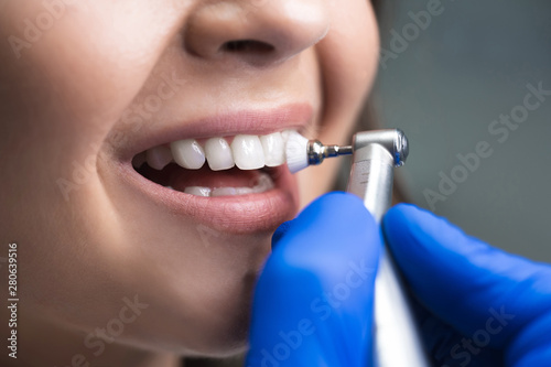 Fototapeta process of using stomatological brush as a stage of professional dental cleaning