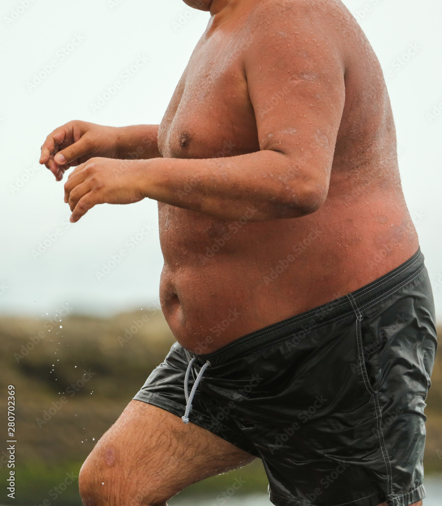 Naklejka premium A fat man burned in the sun