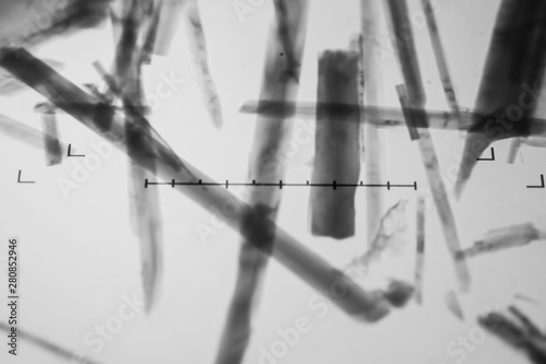 Εκτύπωση καμβά Environmental laboratory, tremolite fibers (asbestos variety) seen on the fluore