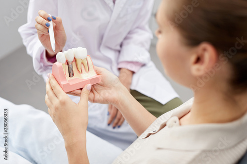 Closeup of unrecognizable female doctor pointing at tooth model while consulting patient, copy space photo