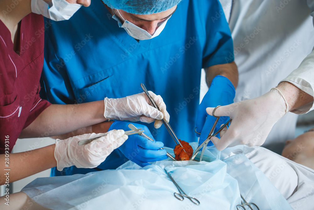 Group of surgeons at work operating in surgical theatre. Resuscitation medicine team wearing protective masks holding steel medical tools saving patient. Surgery and emergency concept. Group of surgeons at work operating in surgical theatre. Resuscitation medicine team wearing protective masks holding steel medical tools saving patient. Surgery and emergency concept.