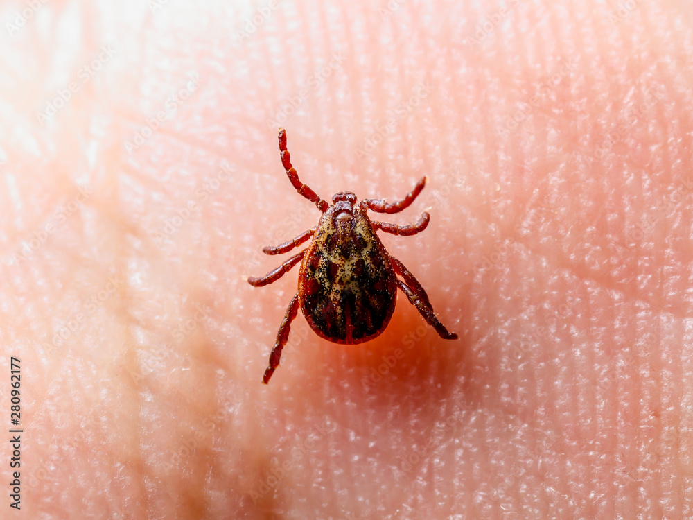 Obraz premium Encephalitis Insect Tick Crawling on Skin. Encephalitis Virus or Lyme Borreliosis Disease Infectious Dermacentor Tick Arachnid Parasite Macro.