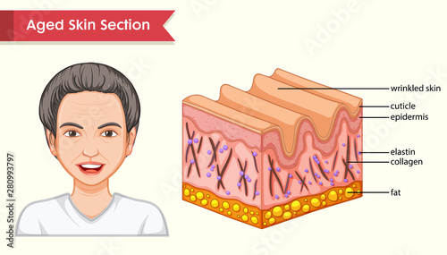 Scientific medical illustration of aged skin with wrinkles
