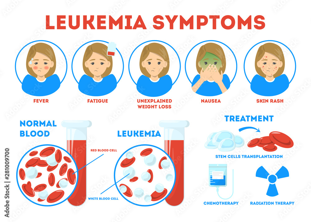 Leukemia Symptoms Infographic Concept Dangerous Disease Treatment 
