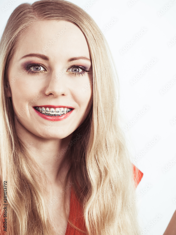 Elegant woman showing her teeth with braces Elegant woman showing her teeth with braces