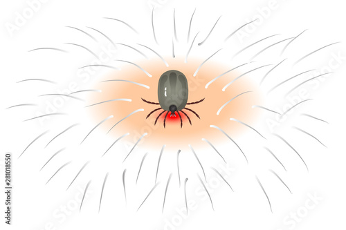 Vector dog tick on a white background Bite the pet Is an insect species The life cycle of an egg is an embryo for an adult teenager.