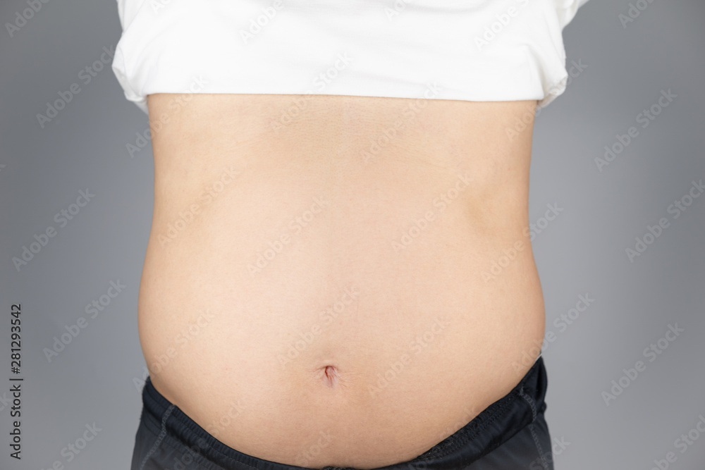 Asian man show the Belly that overweight. It's unhealthy and risk for any disease and sickness.