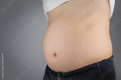 Asian man show the Belly that overweight. It's unhealthy and risk for any disease and sickness.