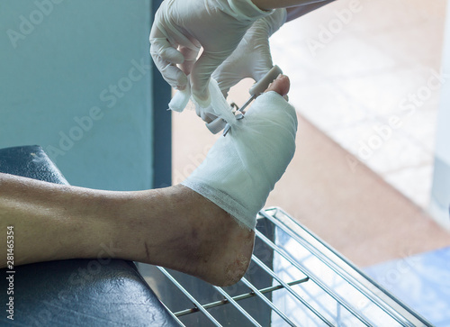 diabetes foot ulcers