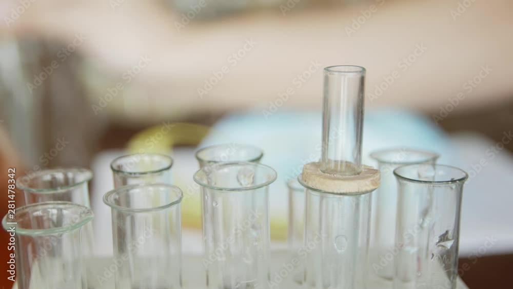 In a university / school laboratory, a student with a pipette analyzes a liquid in the test tubes. Concept: research, biochemistry, study, chemist In a university / school laboratory, a student with a pipette analyzes a liquid in the test tubes. Concept: research, biochemistry, study, chemist