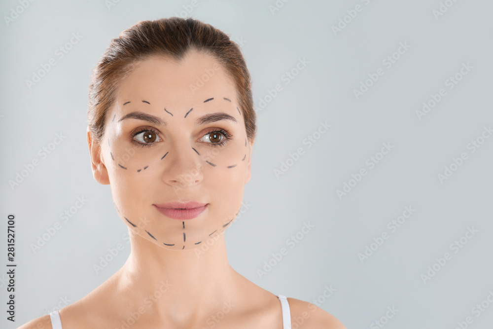 Portrait of woman with marks on face against grey background, space for text. Cosmetic surgery Portrait of woman with marks on face against grey background, space for text. Cosmetic surgery