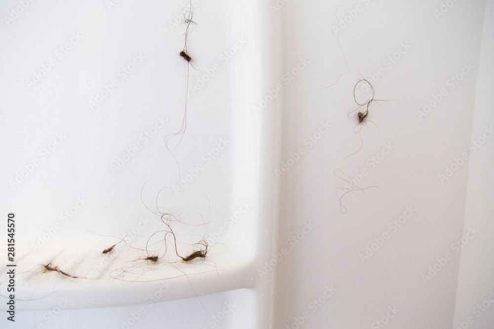 Hair balls in the shower. Hair falling out after pregnancy and