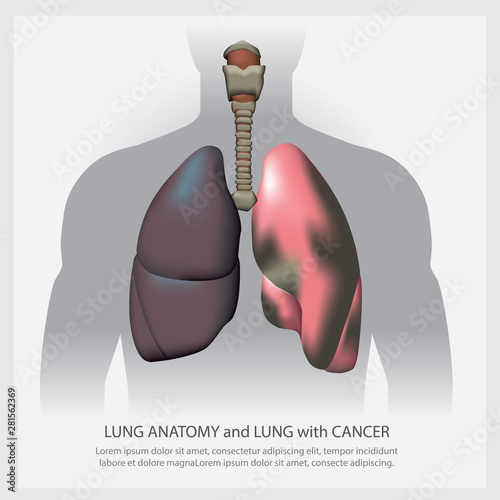 Lung with Detail and Lung Cancer Vector Illustration