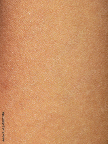 texture of human skin