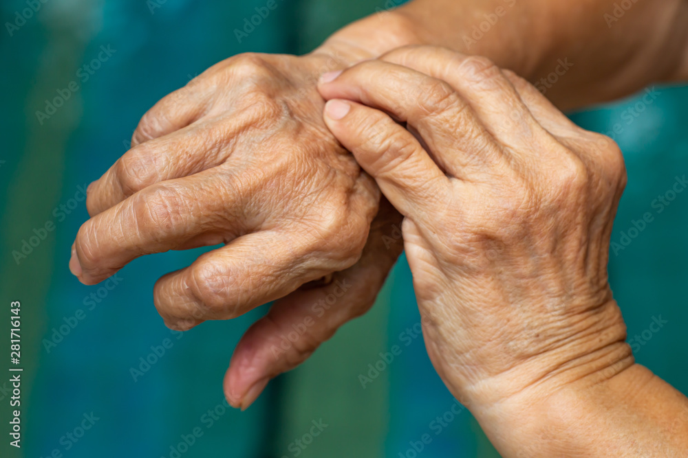 Senior Woman's left hand scratching her right hand, Blue swimming pool background, Close up shot, Asian Body skin part, Healthcare concept